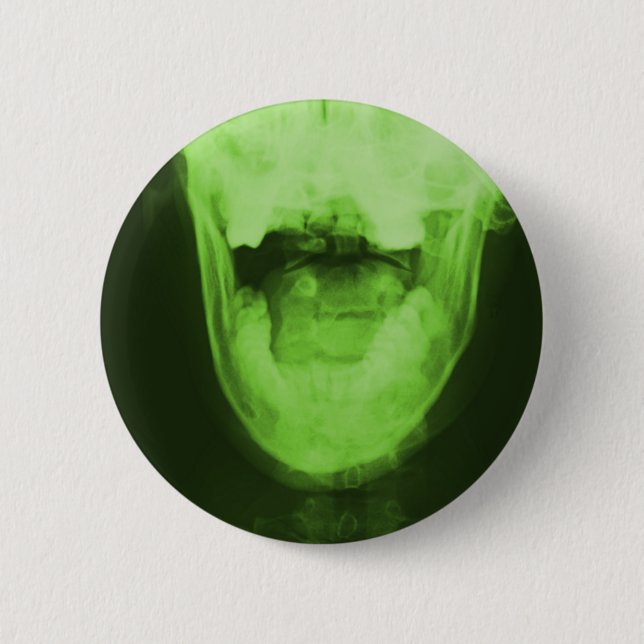 X-rayed 3 - Radioactive Green 6 Cm Round Badge (Front)