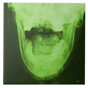 X-rayed 3 - Radioactive Green Tile