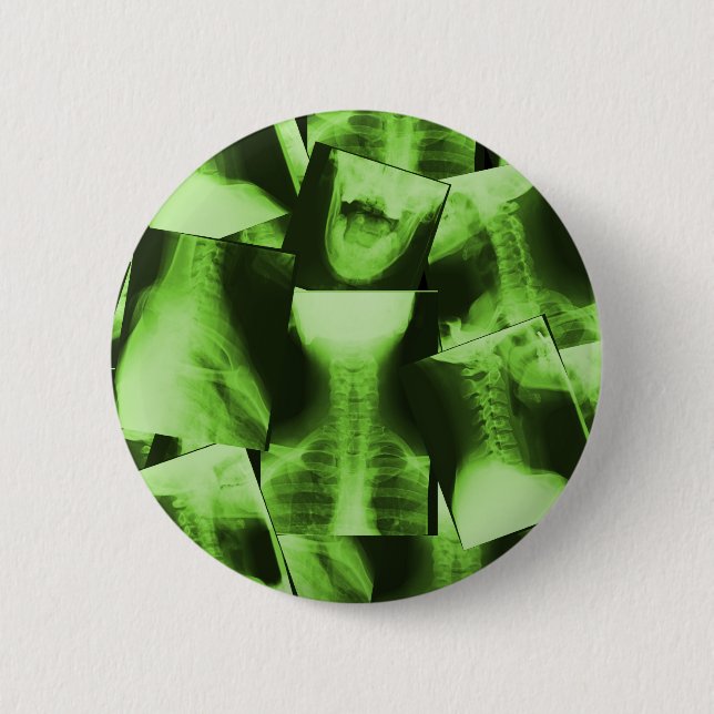 X-rayed - Radioactive Green 6 Cm Round Badge (Front)