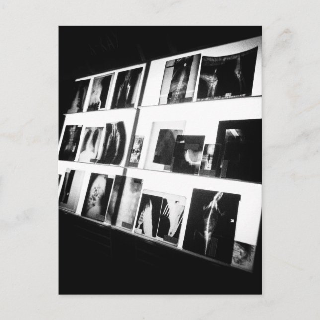 X-Rays Postcard (Front)