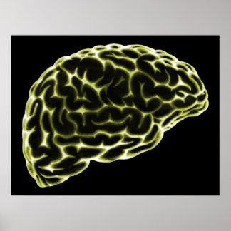 XRAY BRAIN SIDE VIEW YELLOW POSTER