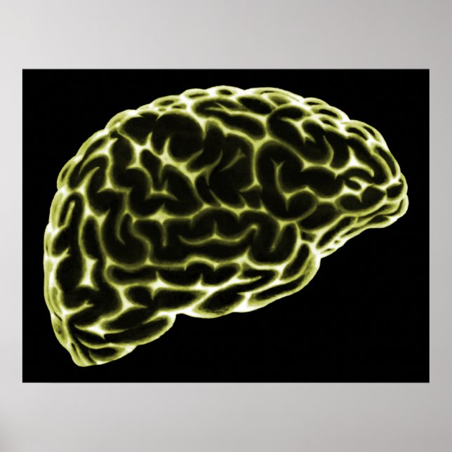 XRAY BRAIN SIDE VIEW YELLOW POSTER (Front)