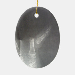Xray Ceramic Tree Decoration