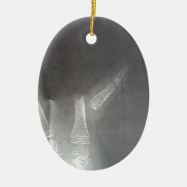 Xray Ceramic Tree Decoration (Front)
