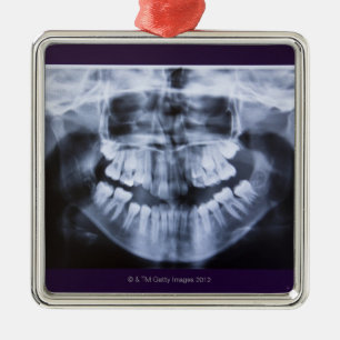 Xray of a girls jawline taken with a panoramic metal tree decoration