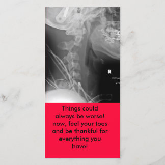 xray, Things could always be worse! now, feel y... Thank You Card
