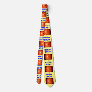 Yellow tie with pictures of a retina