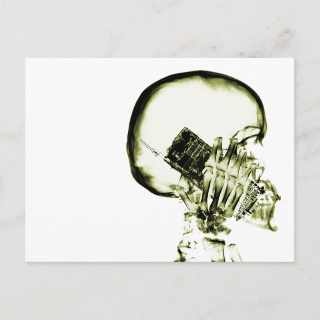 Yellow X-Ray Vision Skeleton Skull Cell Phone Postcard (Front)