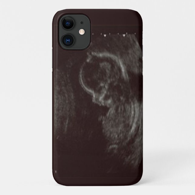 Your Babies Ultrasound Photo Case-Mate iPhone Case (Back)